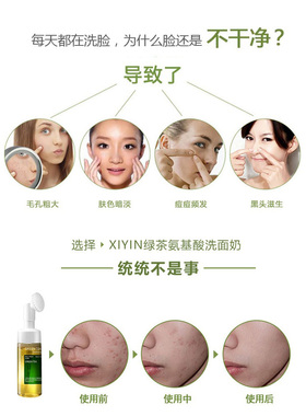 绿茶氨基酸慕斯洗面奶温和控油