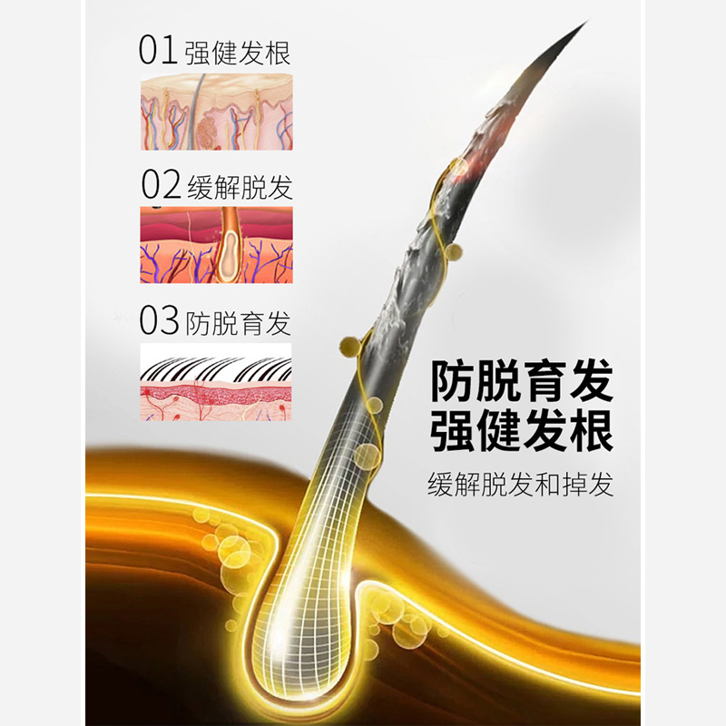 中药洗发水防脱生发控油洗发露增密发固发养发育发人参何首乌男女