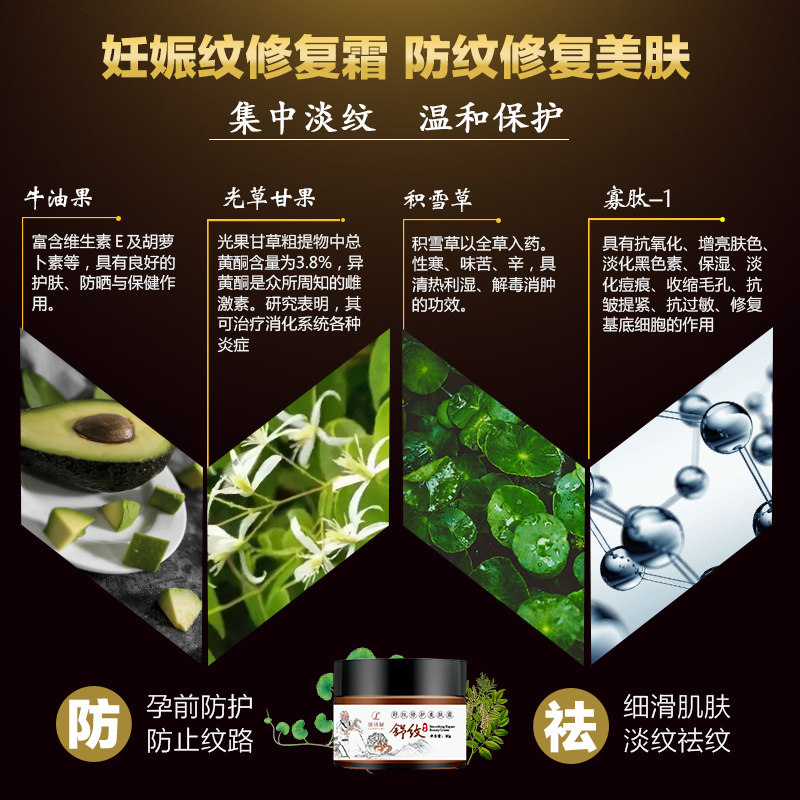 倍可悦孕妇专用去妊娠纹预防修复霜 倍可悦妊娠纹护理