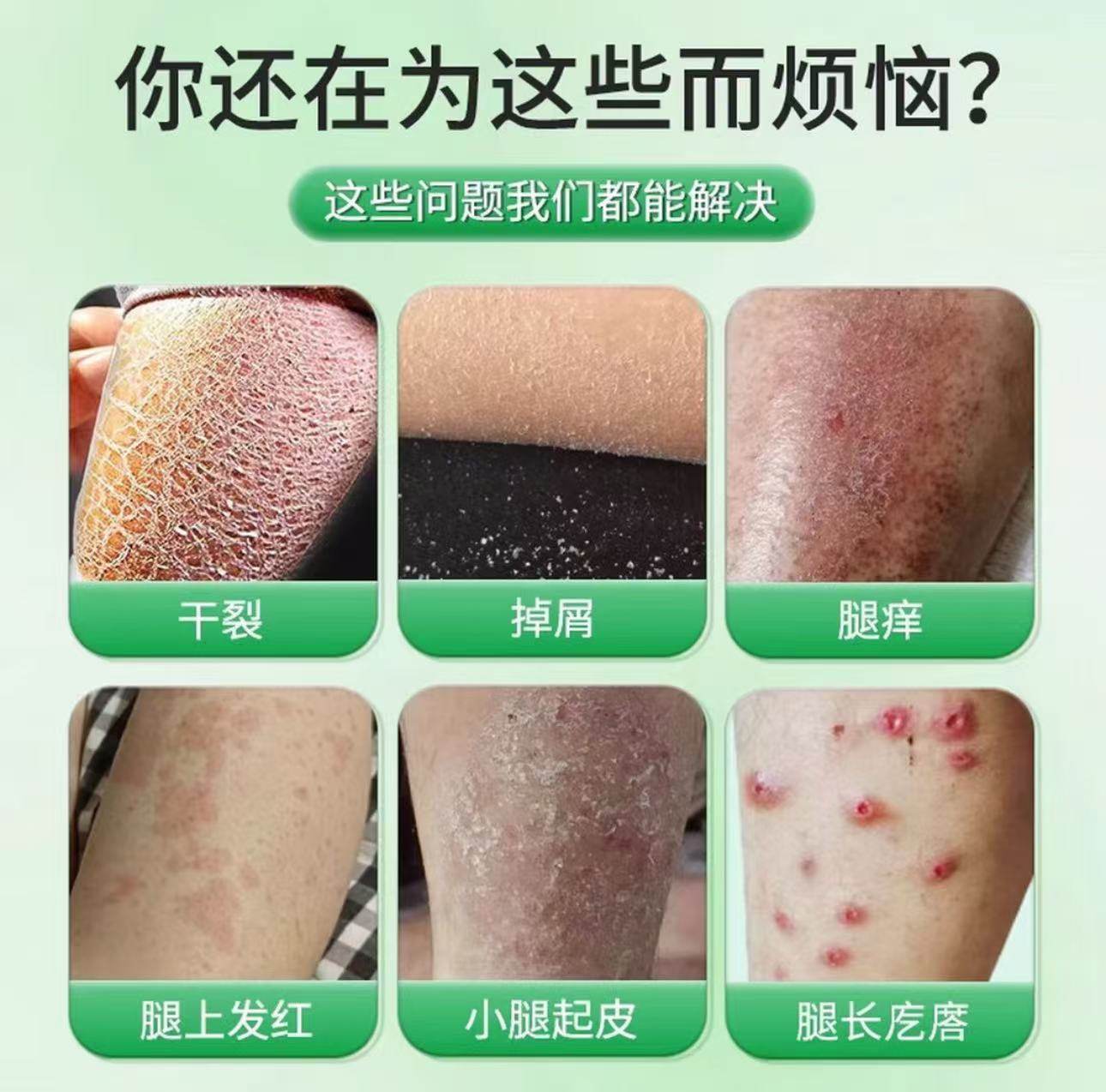 草本抑菌止痒膏皮肤瘙干痒软膏全身外用小腿癣痒冬天专用乳膏正品,淘宝优惠券,粉丝福利购,淘宝优惠卷