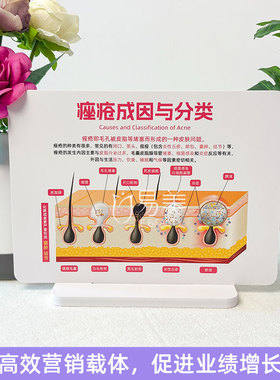 美容院皮肤色斑雪弗板科普摆件