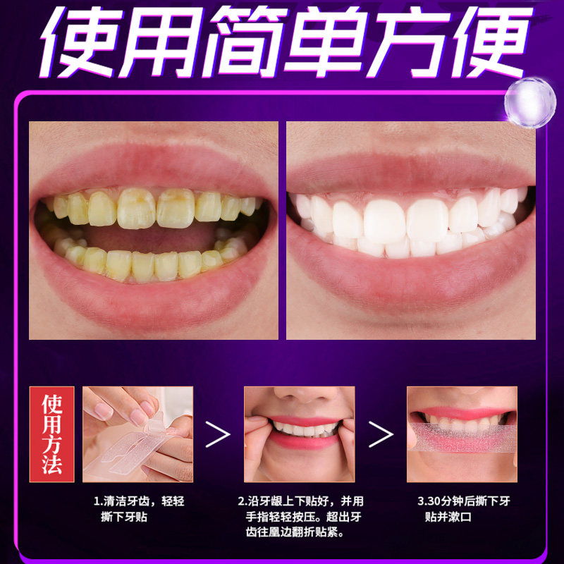 薇娅牙贴面亮白牙齿美神器洁白牙贴 昭亮家居牙齿美白脱色剂