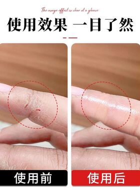 透明手指防裂贴自粘防水防划伤
