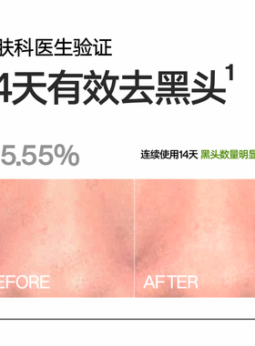 【油皮专研】理然有效控油洁面男