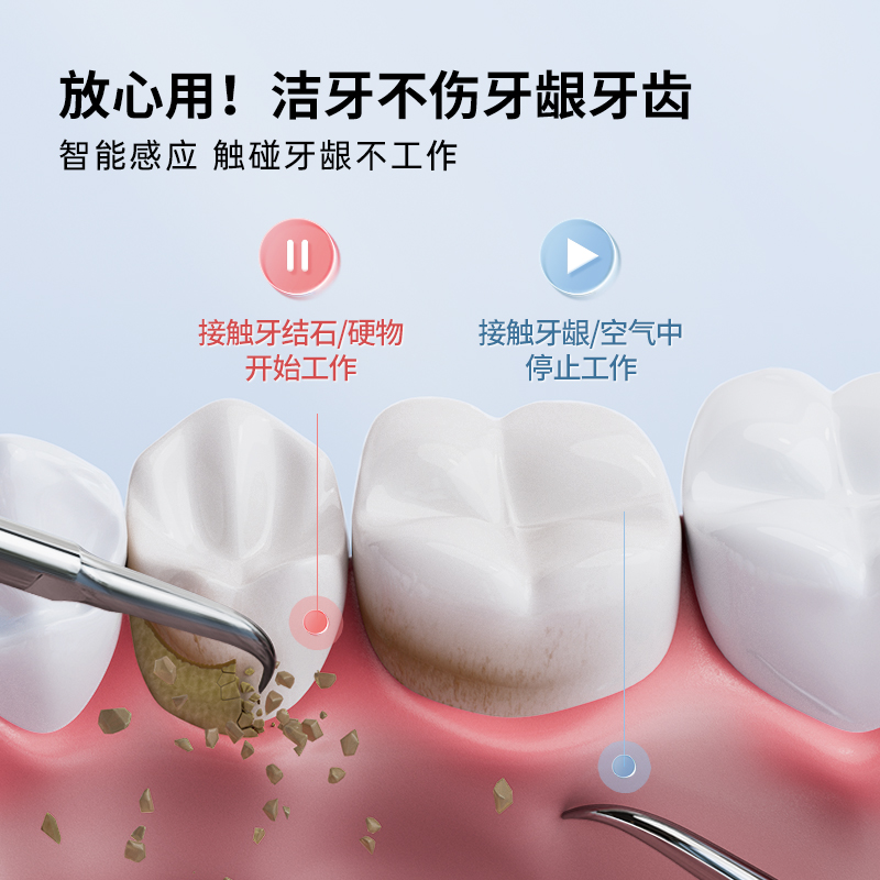 TFLASH同诗超声波洗牙器洁牙仪冲牙结石去除神器洗牙齿污垢器-图2