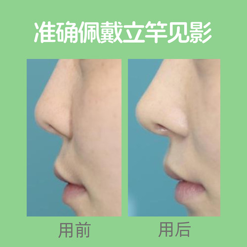 隐形鼻撑鼻子增高变高变挺变小翘鼻神器鼻孔内支撑鼻尖鼻翼缩小贴 - 图1