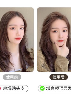 磐玲头发蓬松神器发夹发根