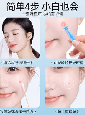 海氏海诺一次性无菌粉刺针