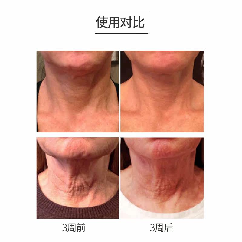 topix replenix绿茶多酚美神经酰胺 Replenix海外颈霜