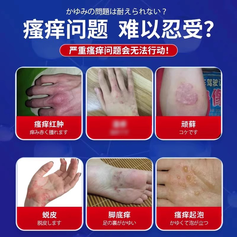 匀美博士维e尿素霜乳膏软膏止痒身上瘙痒皮肤大腿根内侧专用正品 - 图1