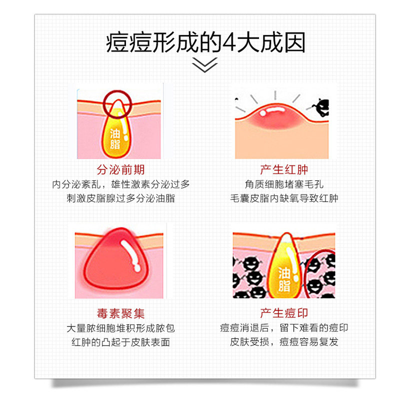 高倩净颜清痘护理套装粉刺淡化痘印 kotte高倩面部护理套装