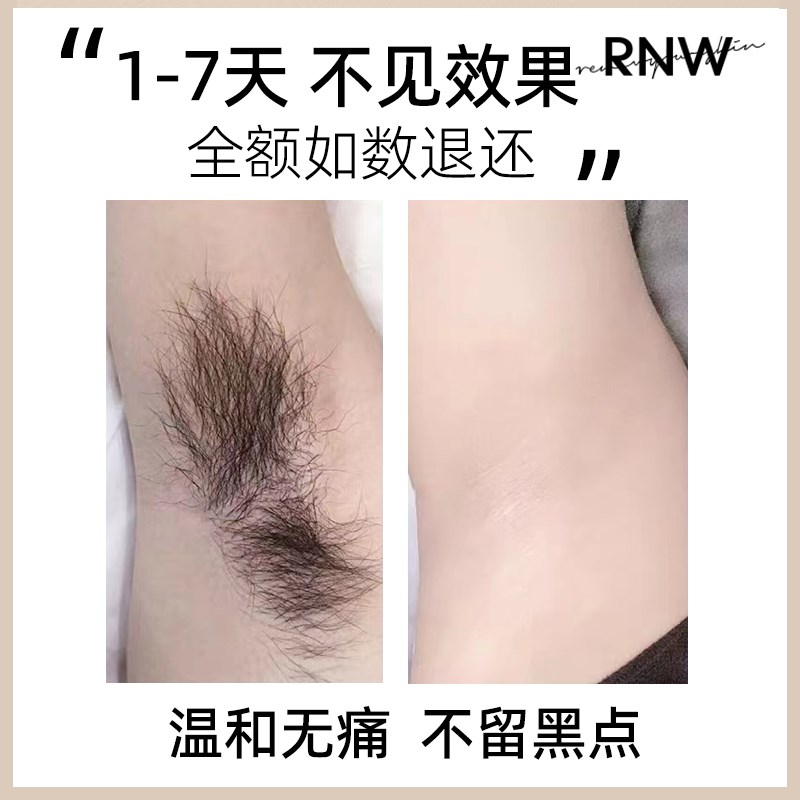 RNW如薇脱毛膏女腋下全身去腿毛腋毛非不私处男女士学生专用-图1