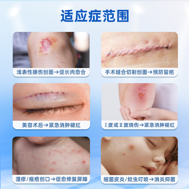 浔药医用创面促愈凝胶手术伤口愈合儿童创面烧伤烫伤修复减瘢凝胶