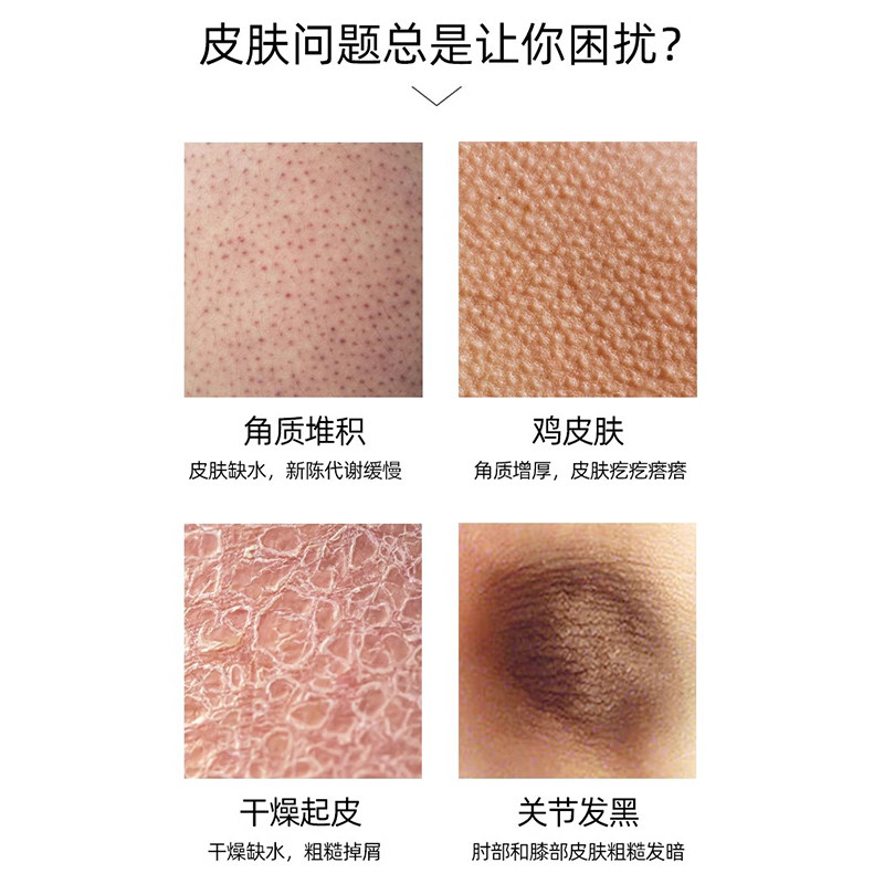 雪玉维E尿素霜护手霜改善粗糙皮肤维生素e身体乳疙瘩毛囊角化