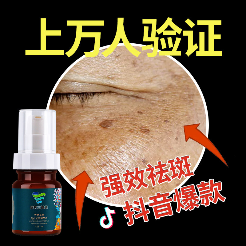 国药集团去斑祛黄褐斑男神器祛斑霜 eec乳液/面霜