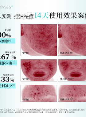 冰溪壬二酸焕颜精华霜