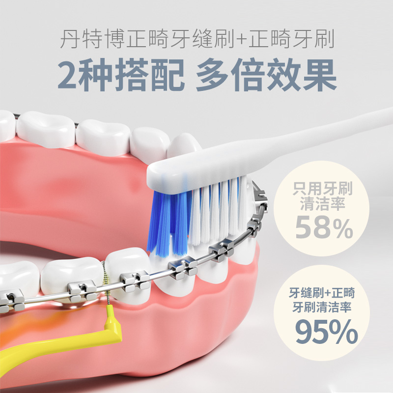 日本丹特博L型牙缝刷正畸牙间刷间隙刷矫正牙齿清洁牙缝i型牙缝刷