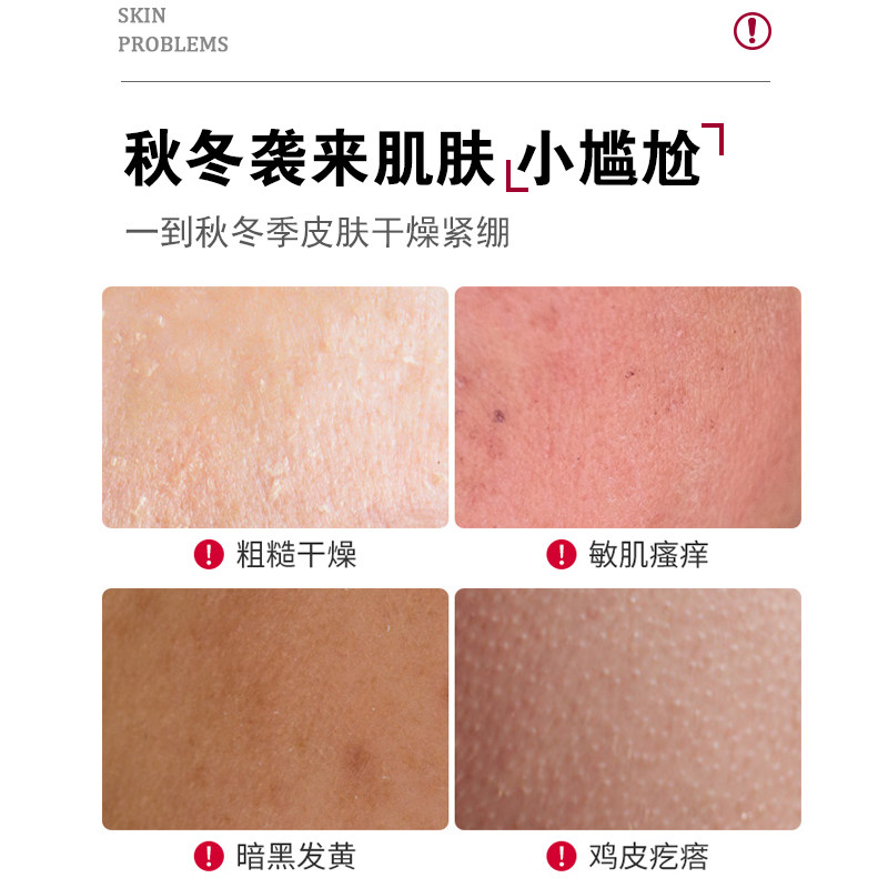 时通止痒干燥保湿滋润修护身体乳液 时通身体乳液