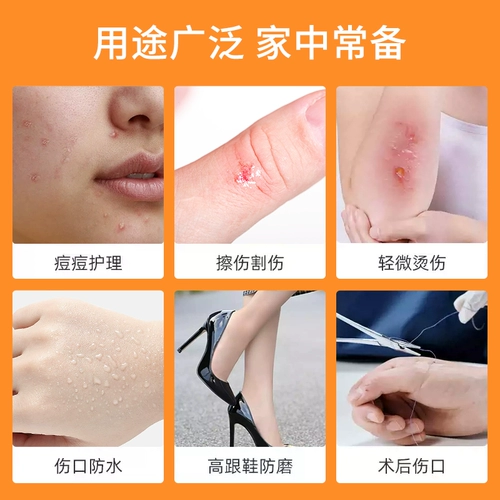 Oichibo aisi Медицинские перидальные прыщи Прык Прык