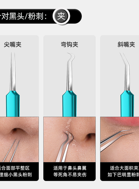 粉刺针细胞夹5件套黑头超细