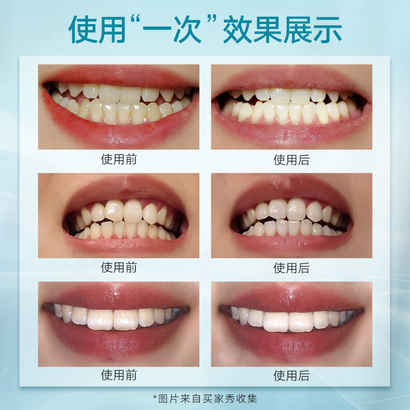 wildwood唯悟速白美白神器14对牙贴 wildwood牙齿美白脱色剂