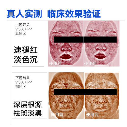 丽舒丹氨甲环酸烟酰胺HAB5共识浓度推荐 控红美白祛斑特证 防反黑 - 图3