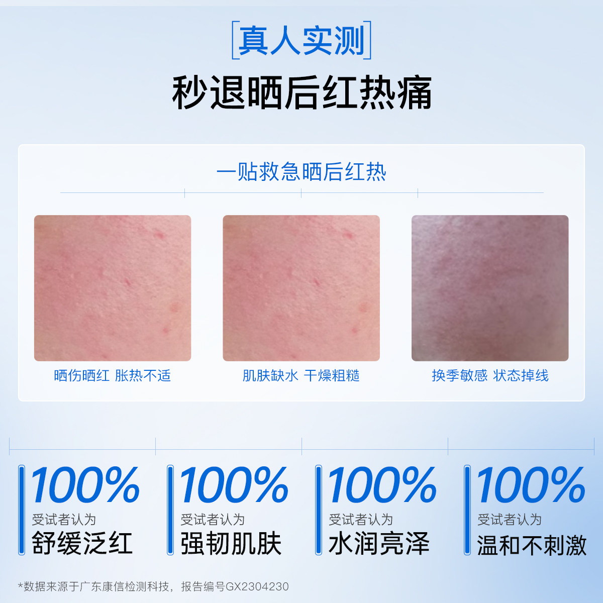 斐思妮二裂酵母冰膜晒后修护褪红补水保湿舒缓敏肌贴片式面膜