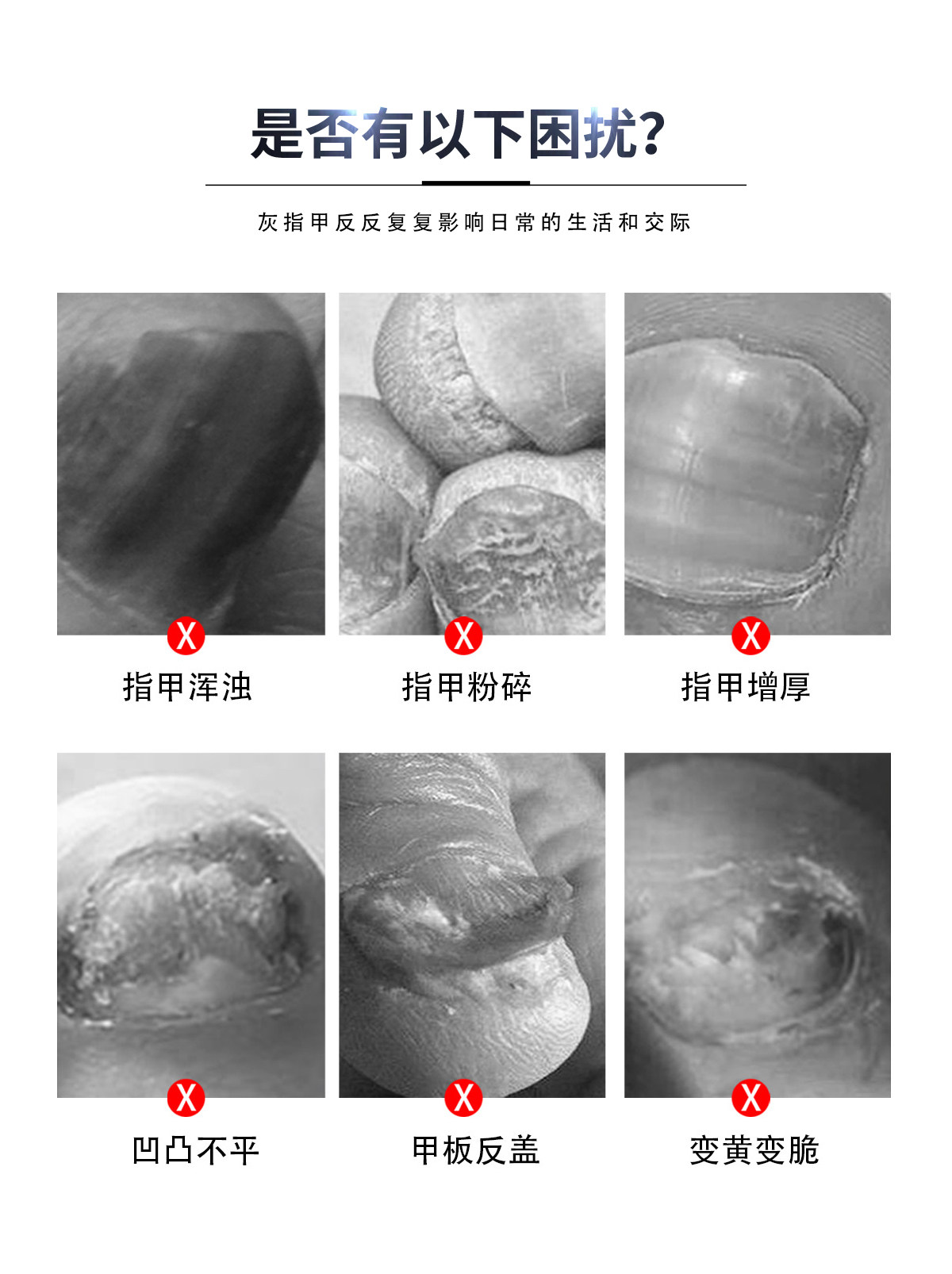  品诗嫚膏药贴（器械）