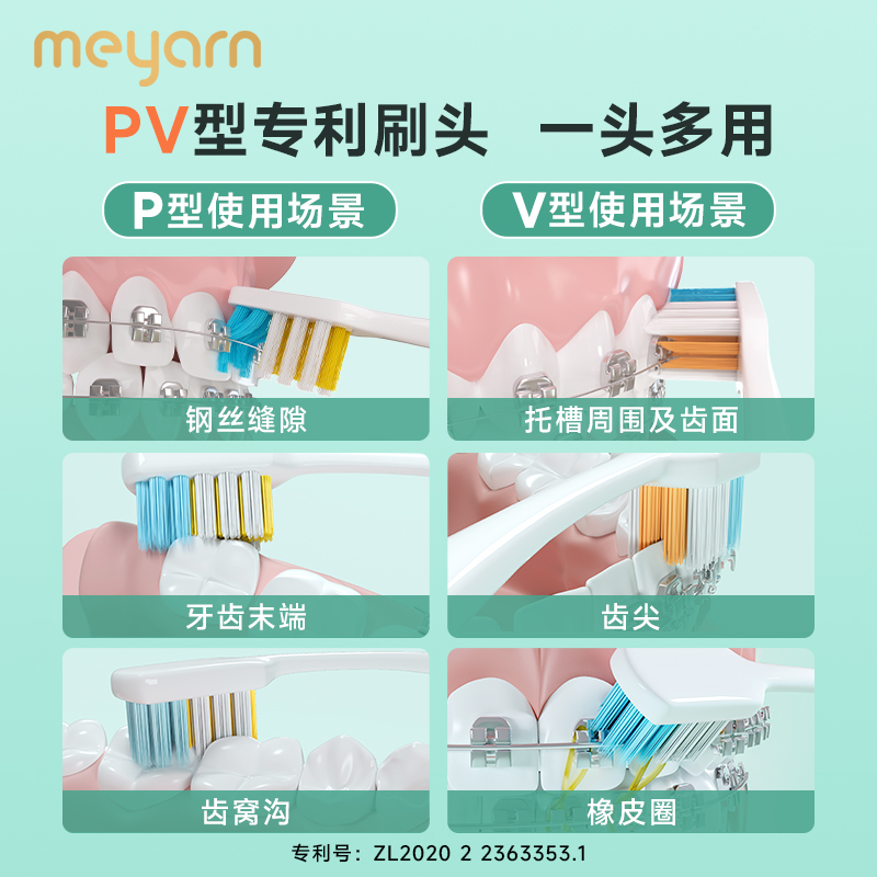 meyarn米妍PV款正畸牙刷矫正牙齿专用戴牙套成人软毛青少年牙缝刷