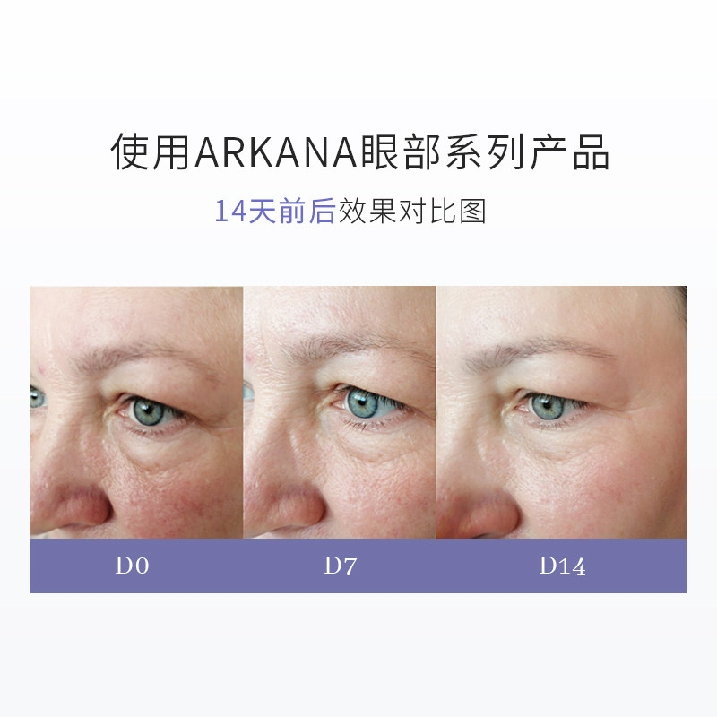 arkana /波兰大a eye complex care ARKANA海外眼霜