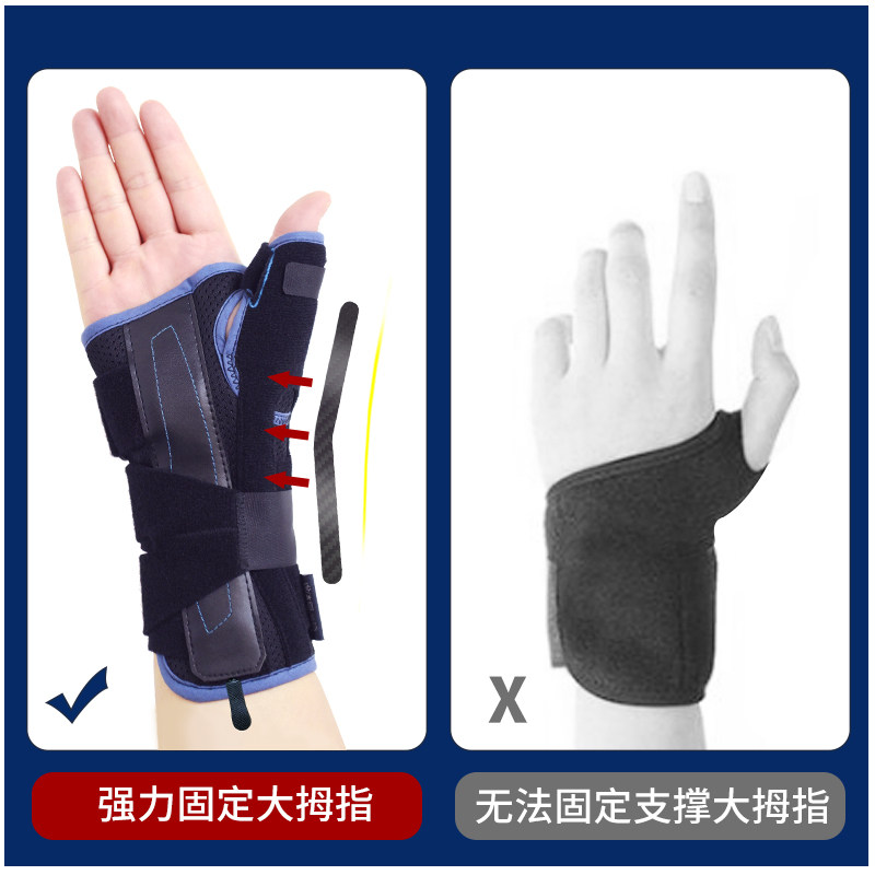 腱鞘炎医用妈妈手腕骨折拇指护腕 velpeau医疗器械护具（器械）