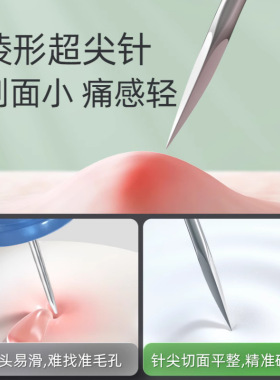 苗老祖三棱针专业祛痘三菱针美容院专用排挤痘痘闭口暗疮工具清痘