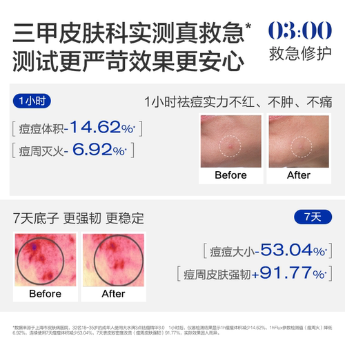 大水滴3点祛痘精华3.0 青少年学生党祛痘救急修护瘪痘净痘淡红印 - 图1