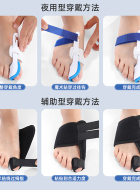 南极拇指可穿鞋分离外翻矫正器