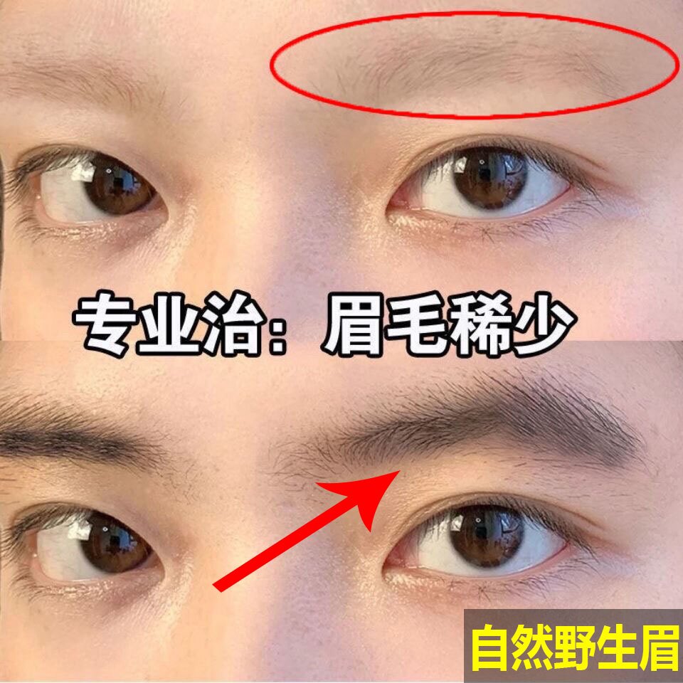 眉毛增长液男22年3月 月销口碑最新推荐 天猫淘宝海外