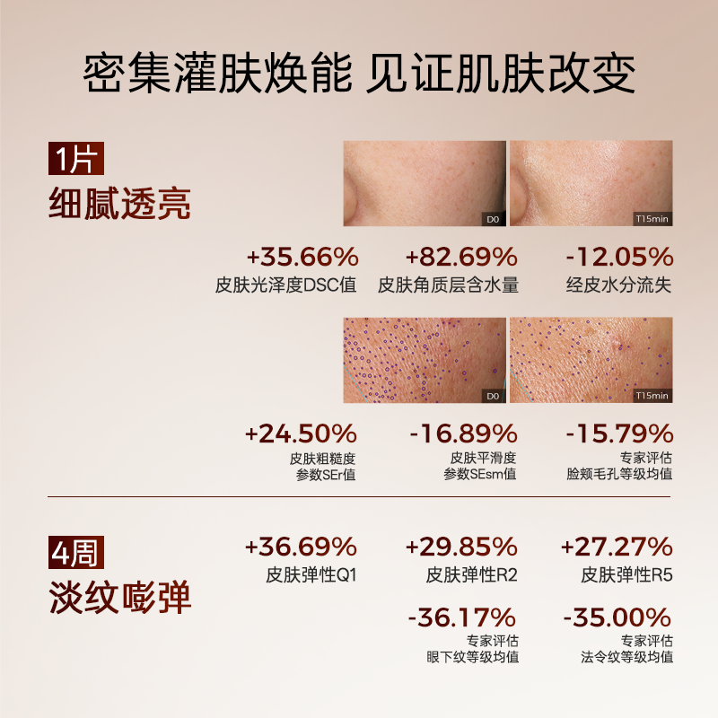 �����ֱ���� �����ͷ�Ĥ��Ĥ ������µ����޻� �������� 3�� 199.12Ԫ(����ȯ)