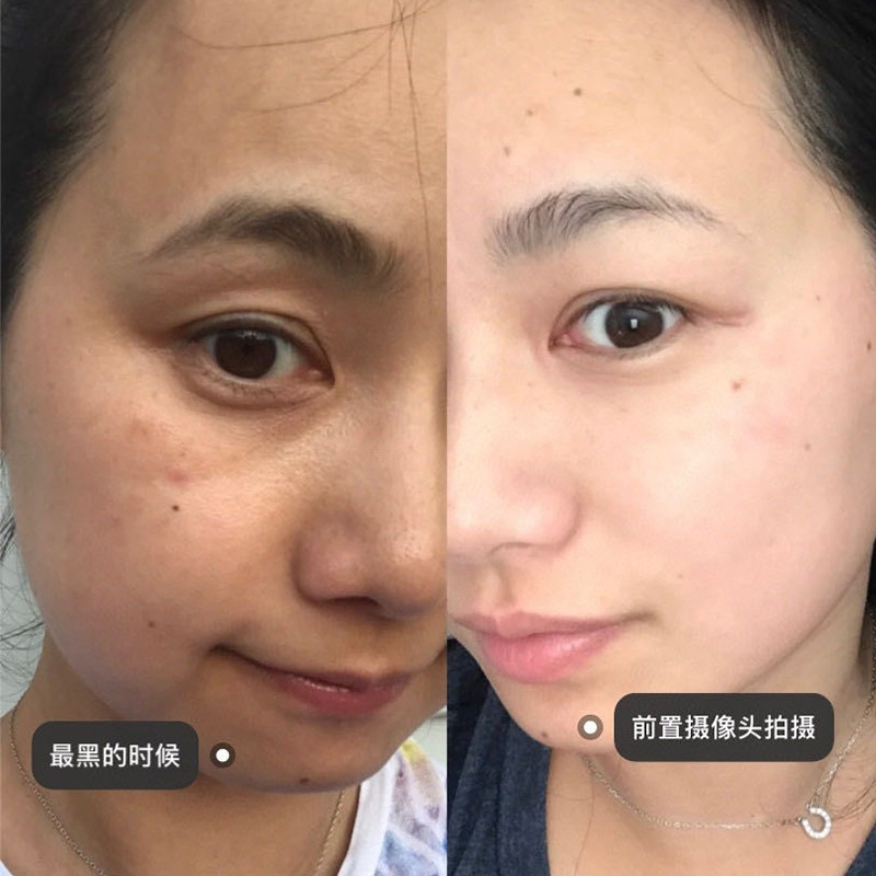 377美白祛斑次抛精华液熊果苷烟酰胺嫩白去黄淡斑霜改善暗沉肤色,淘宝优惠券,粉丝福利购,淘宝优惠卷