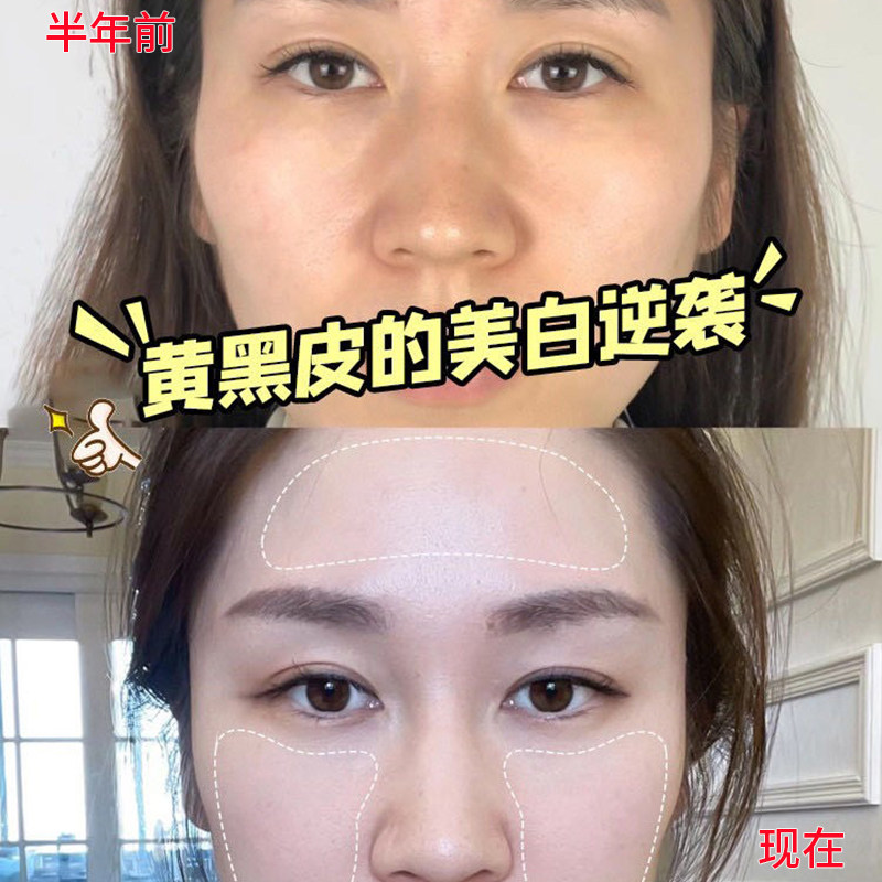 377美白祛斑次抛精华液熊果苷烟酰胺嫩白去黄淡斑霜改善暗沉肤色,淘宝优惠券,粉丝福利购,淘宝优惠卷