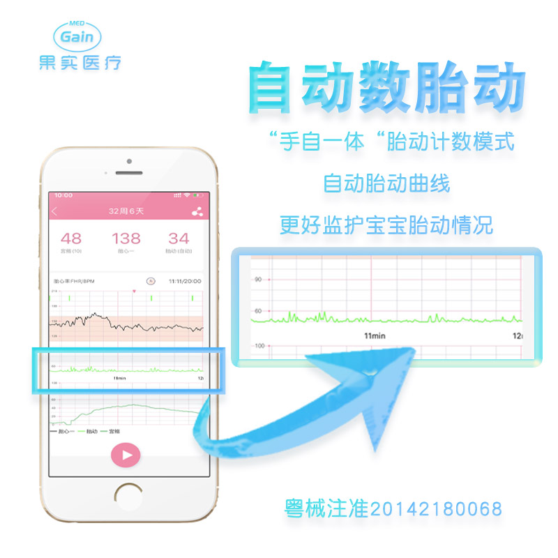果实医疗医院同款多普勒胎心监测仪胎儿测胎心监护仪孕妇家用租赁 - 图0