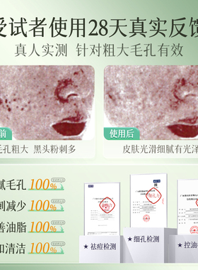 氨基酸洗面奶净澈毛孔
