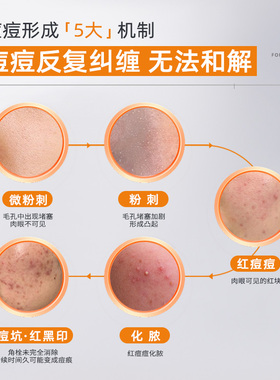 快速消痘片仔癀祛痘凝胶祛痘膏贴