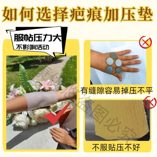 3D圆柱疤痕加压垫烧烫伤儿童医用术后凸起防增压生贴硅凝胶增压垫 - 图0
