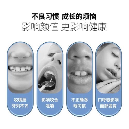 口唇肌训练器儿童口呼吸嘴唇外翻腺样体面容矫正器防吸下嘴唇神器 - 图0