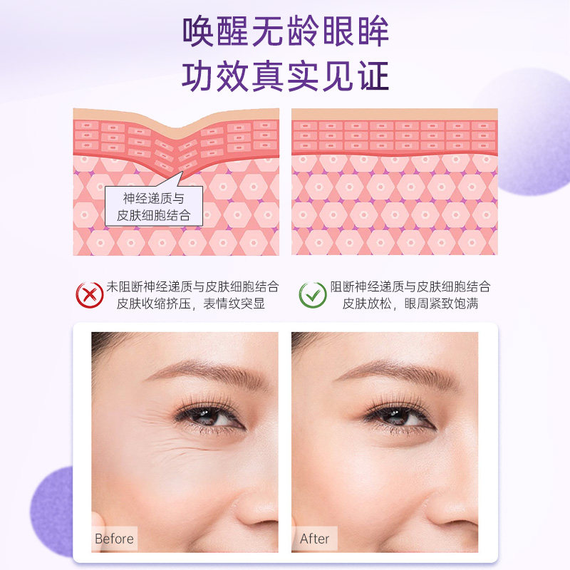 澳洲freezeframe淡化黑眼圈淡眼霜 freezeframe芙日菲海外眼霜