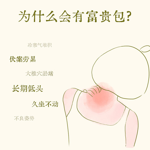 真不二大马士革玫瑰颈贴热敷艾灸贴富贵包肩颈热敷包颈椎脖子蒸汽 - 图0