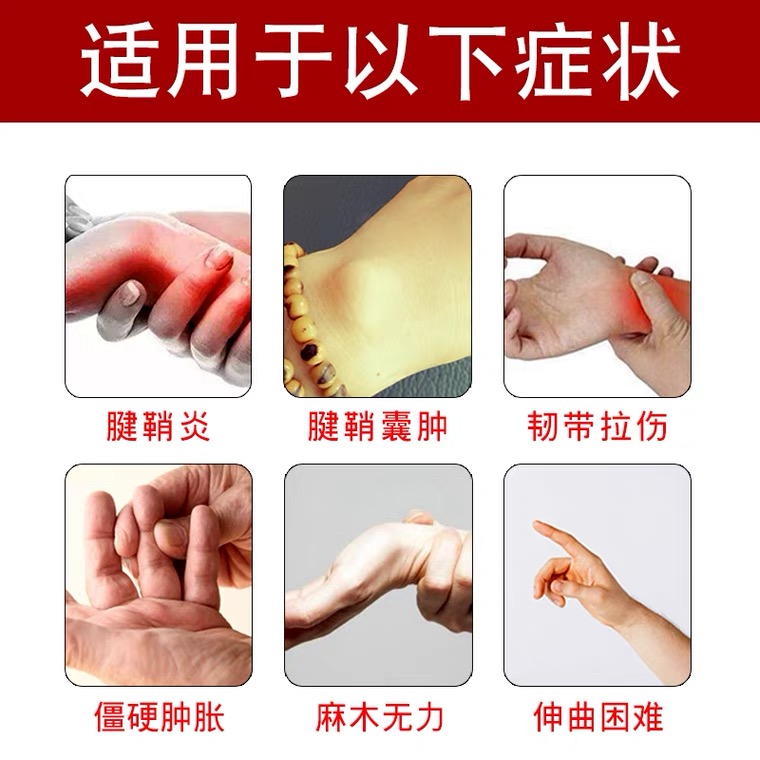华北制药腱鞘炎喷剂旗舰店膏药贴 小禾诗蔓医疗器械保健理疗