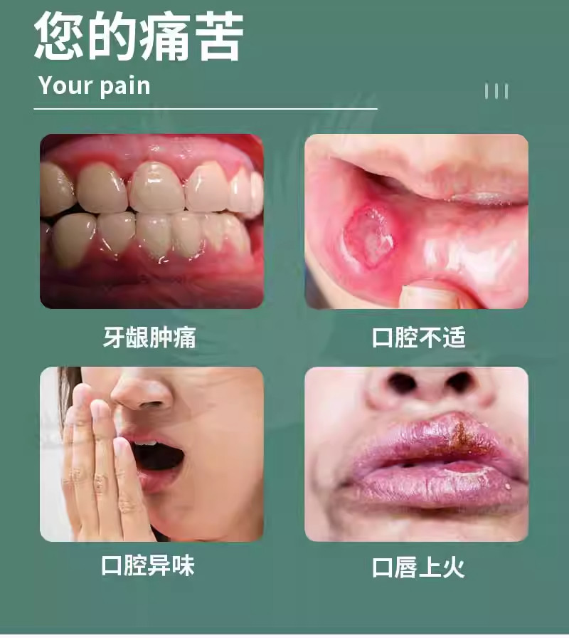  小禾诗蔓医疗器械口腔健康