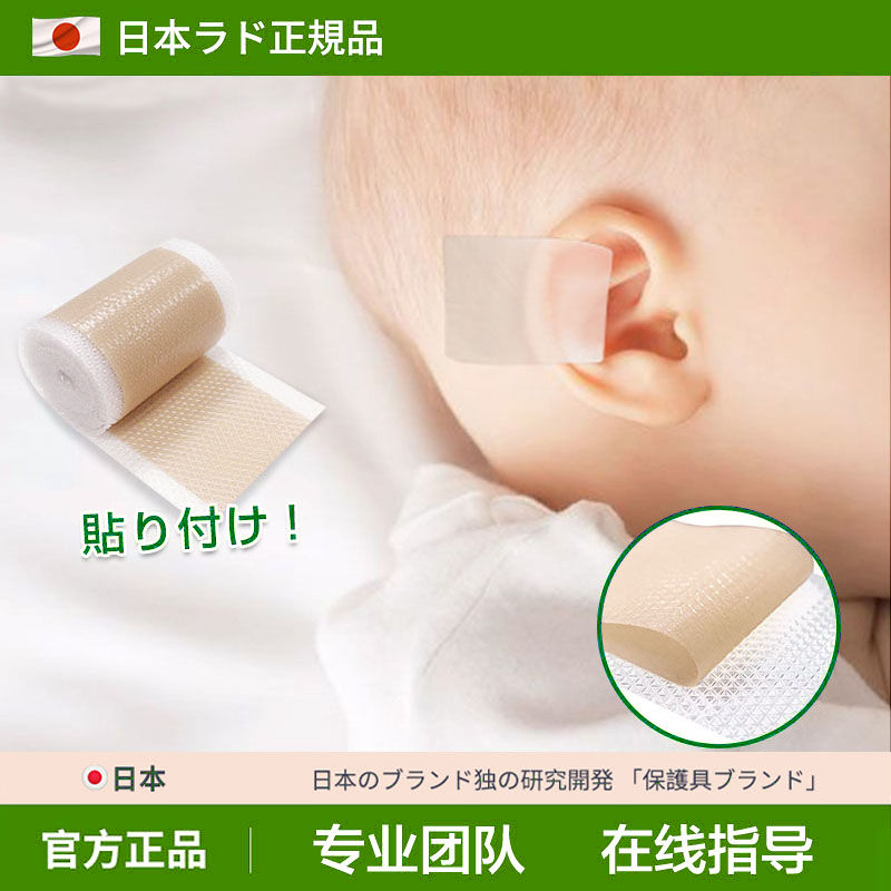 日本耳廓矫正器婴儿耳撑新生的儿宝宝耳朵定型招风耳神器硅胶耳贴