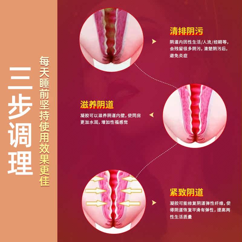 妇炎洁缩阴私处紧致收缩妇科凝胶 妇炎洁穗生保健理疗