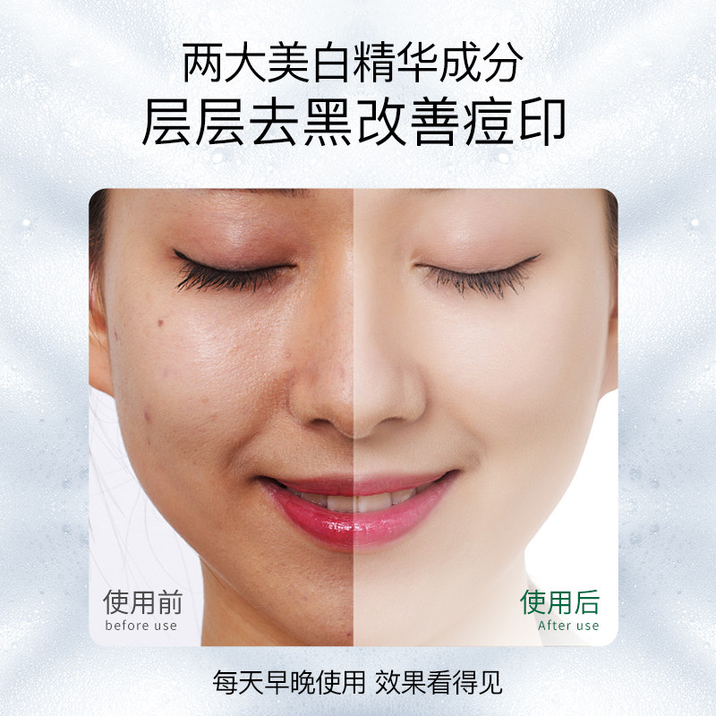 bodyaid博滴波斯顿美白控油洗面奶 bodyaid洁面